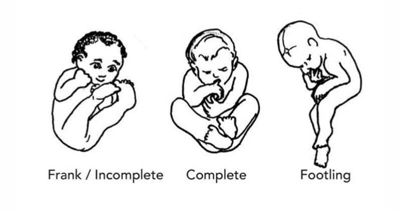 Instagram.com/spinningbabies